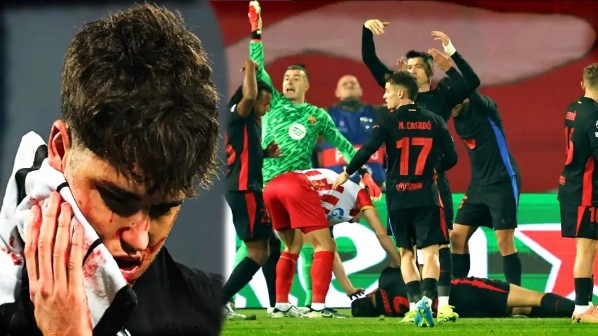 Cubarsi dính chấn thương